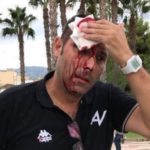 Ispanijoje neramu, į filmuojančius įvykius policija šaudo guminėmis kulkomis(video)